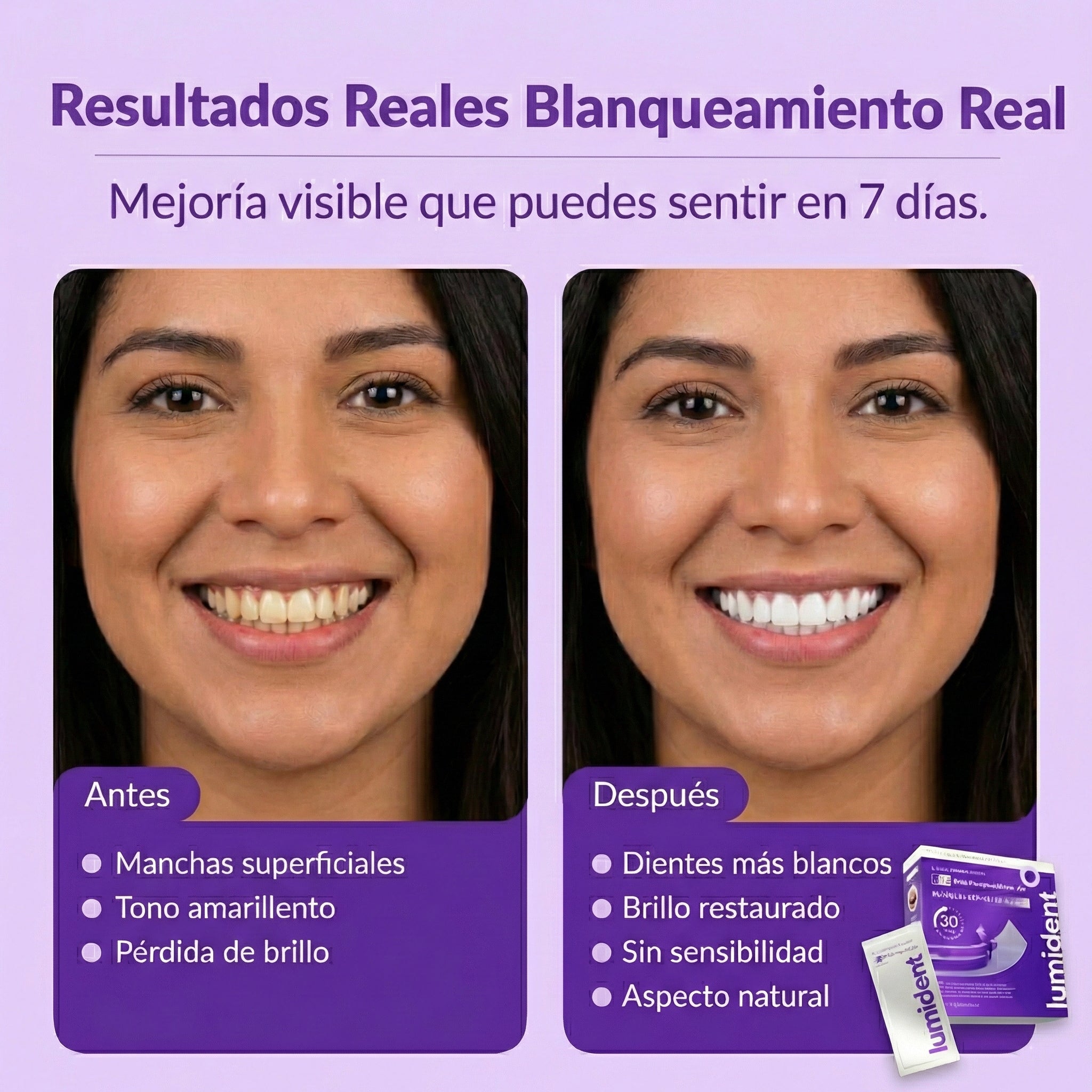 Lumident™ Tiras de Blanqueamiento Dental